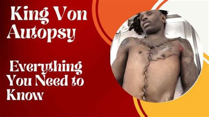 Exploring The Life And Legacy Of King Von: A Deep Dive Into His Autopsy