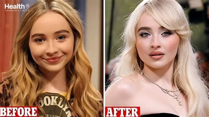 Inside The Transformation: Sabrina Carpenter's Plastic Surgery Journey