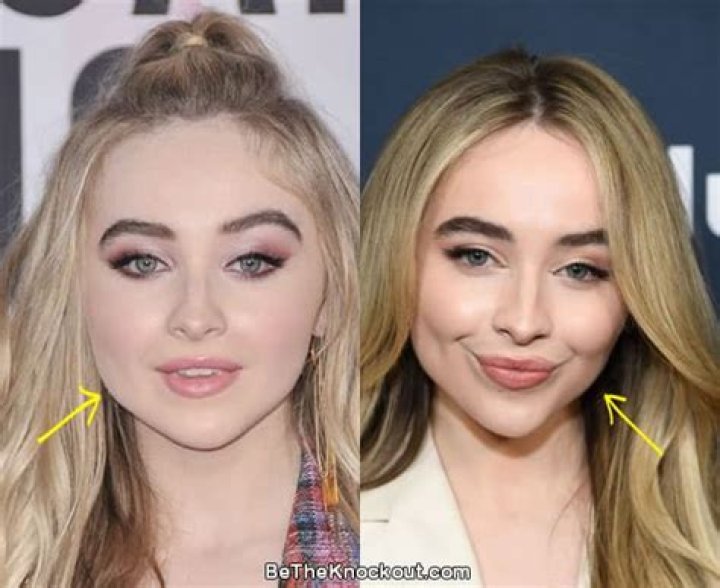 Sabrina Carpenter: A Glimpse Before Botox