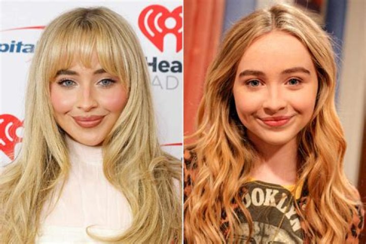 Sabrina Carpenter: A Look Into Her Plastic Surgery Journey Before And After