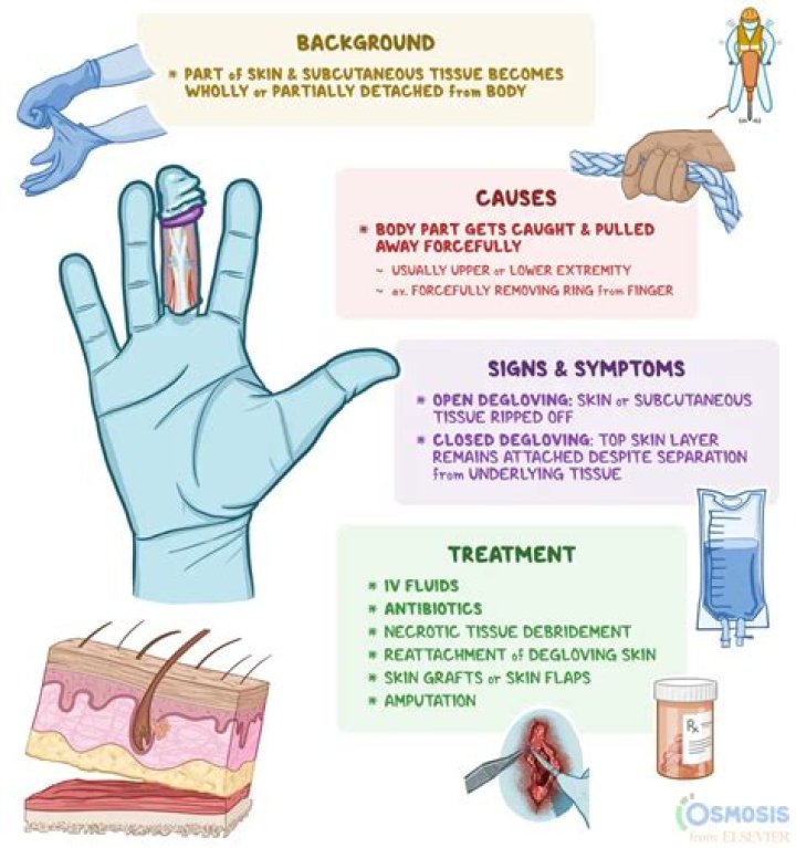 Understanding The Impact Of A Degloved Face: Causes, Treatments, And Recovery